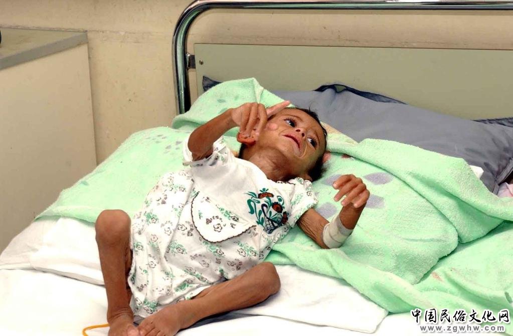 向乌克兰送“毒弹”,此举遭多方谴责