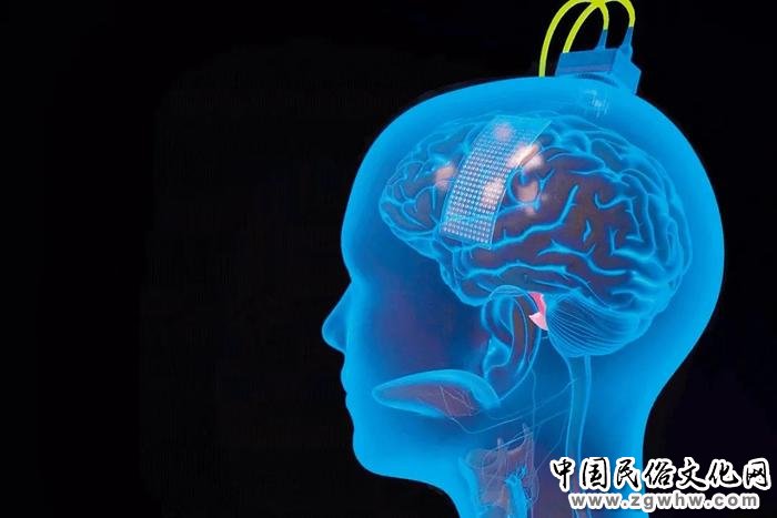 安的大脑表面植入了一个薄薄的矩形电极,以接收其试图说话时发出的信号。图/加州大学